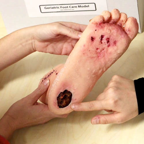 Geriatric Foot Care Model