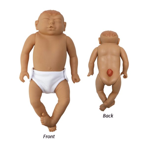 Birth Defects Baby Front And Back